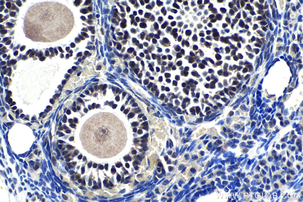 Immunohistochemical analysis of paraffin-embedded mouse ovary tissue slide using KHC1184 (XRCC4 IHC Kit).