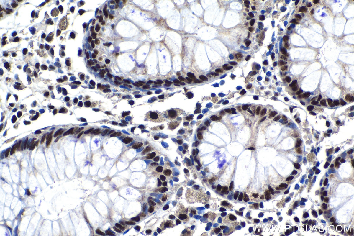 Immunohistochemical analysis of paraffin-embedded human colon tissue slide using KHC1184 (XRCC4 IHC Kit).