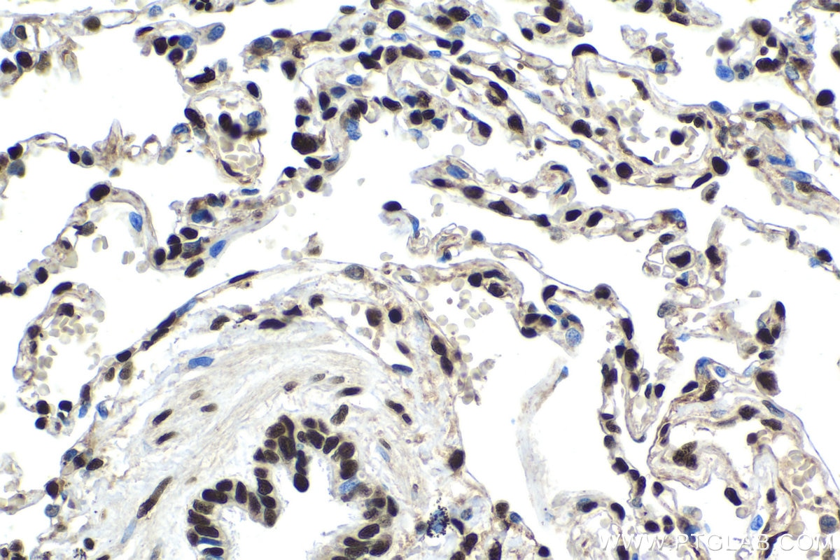 Immunohistochemical analysis of paraffin-embedded human lung tissue slide using KHC1528 (XRCC5 IHC Kit).