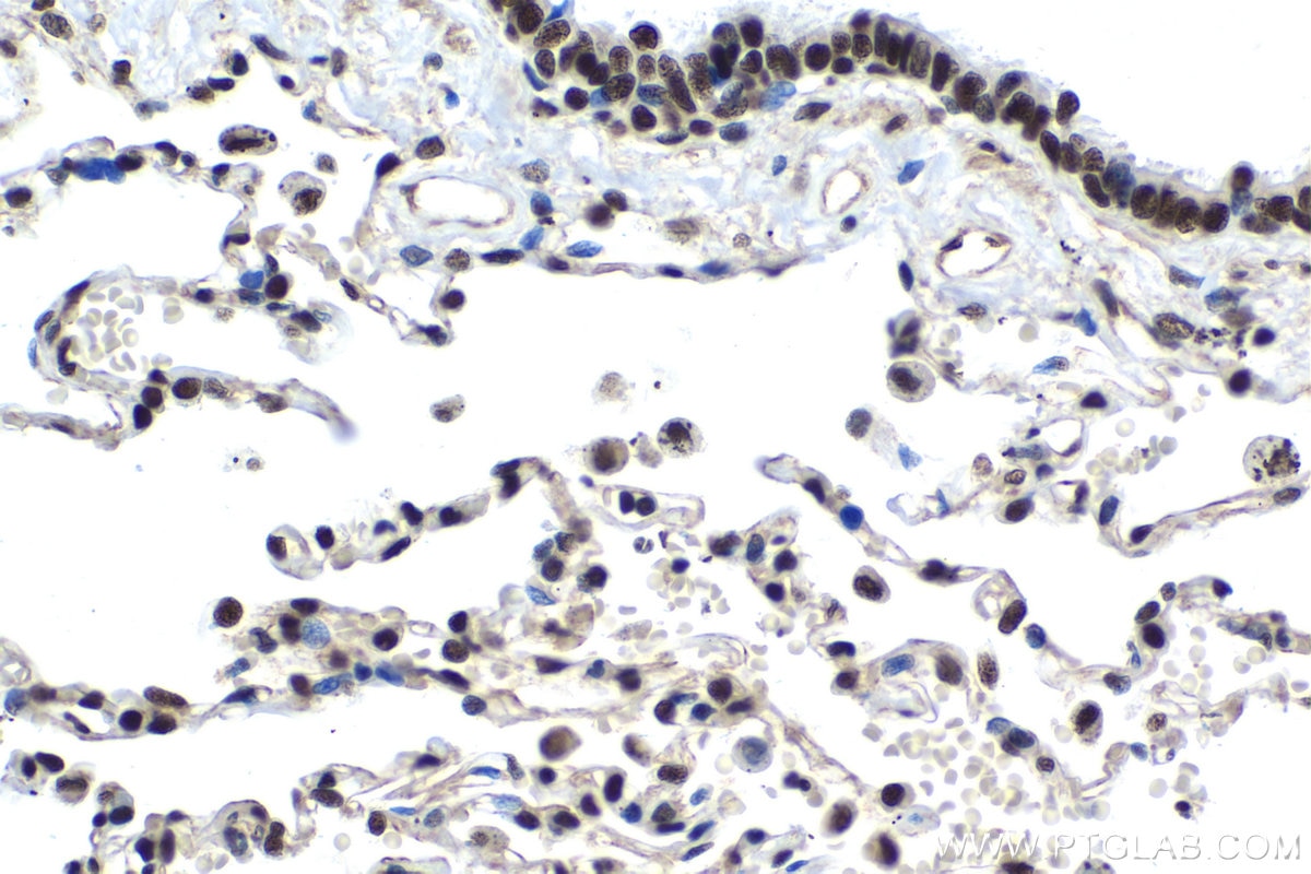 Immunohistochemical analysis of paraffin-embedded human lung tissue slide using KHC1527 (XRCC6 IHC Kit).