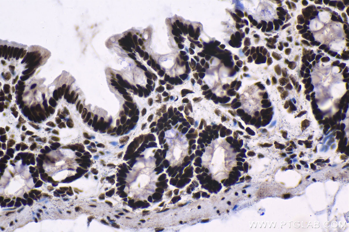 Immunohistochemical analysis of paraffin-embedded rat colon tissue slide using KHC1381 (XRN2 IHC Kit).