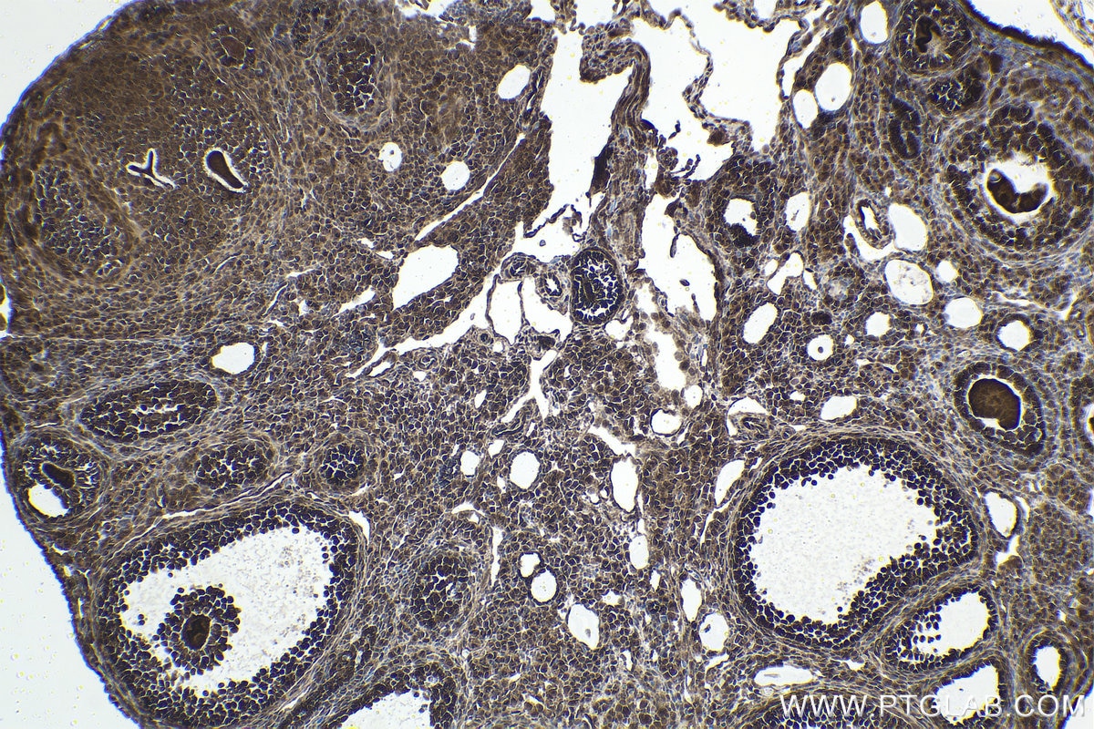 Immunohistochemical analysis of paraffin-embedded mouse ovary tissue slide using KHC1608 (YAP1 IHC Kit).