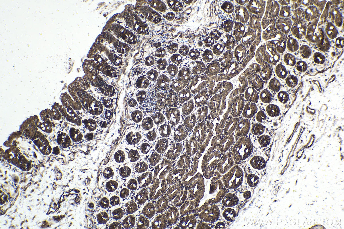 Immunohistochemical analysis of paraffin-embedded mouse small intestine tissue slide using KHC1608 (YAP1 IHC Kit).