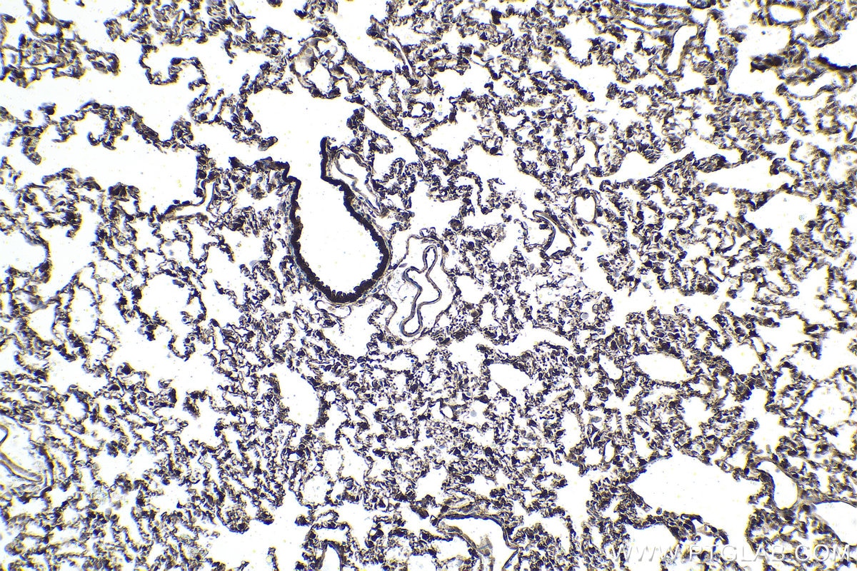 Immunohistochemical analysis of paraffin-embedded rat lung tissue slide using KHC1608 (YAP1 IHC Kit).