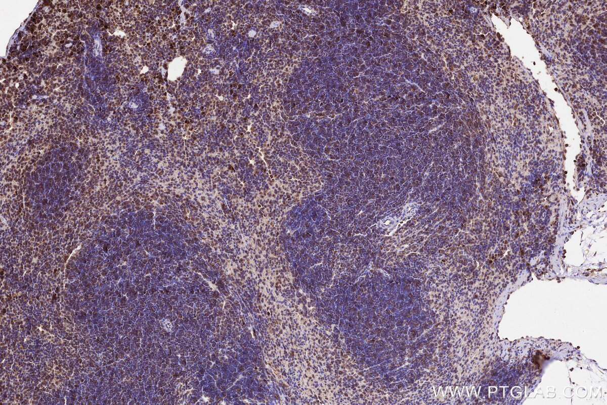 Immunohistochemical analysis of paraffin-embedded mouse spleen tissue slide using KHC3228 (YARS IHC Kit). Immunohistochemical analysis of paraffin-embedded mouse spleen tissue slide using KHC3228 (YARS IHC Kit).