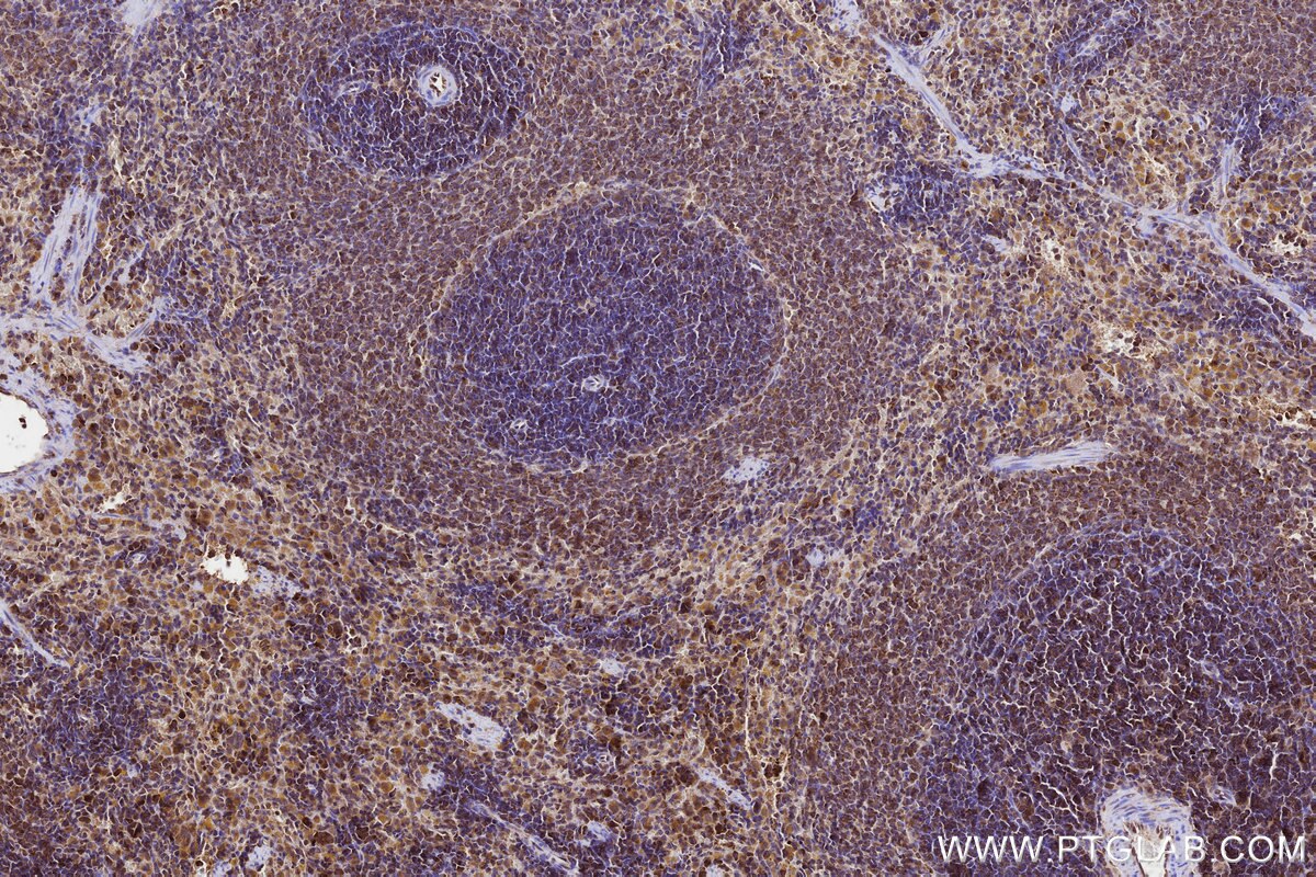 Immunohistochemical analysis of paraffin-embedded rat spleen tissue slide using KHC3228 (YARS IHC Kit). Immunohistochemical analysis of paraffin-embedded rat spleen tissue slide using KHC3228 (YARS IHC Kit).