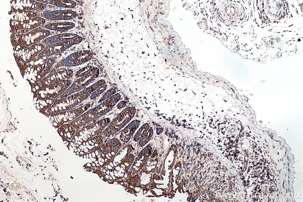 Immunohistochemical analysis of paraffin-embedded mouse colon tissue slide using KHC0176 (YBX1 IHC Kit).