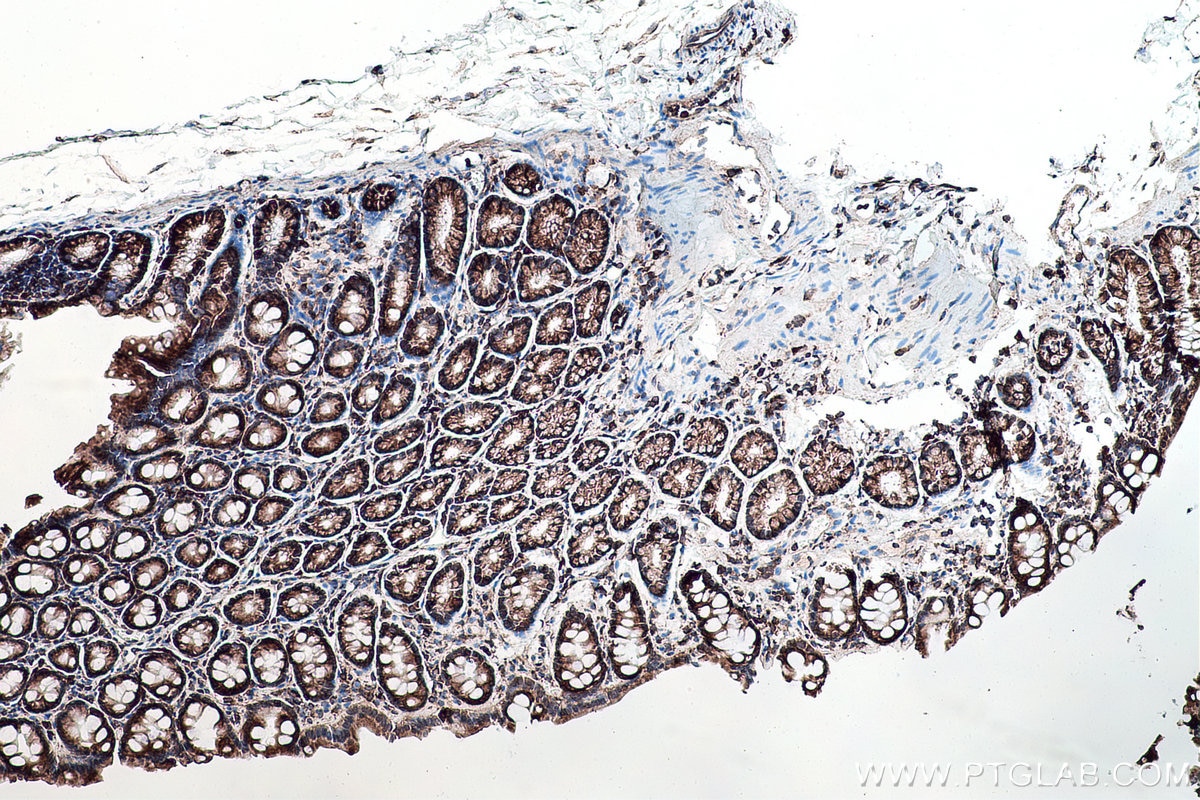 Immunohistochemical analysis of paraffin-embedded rat colon tissue slide using KHC0176 (YBX1 IHC Kit).