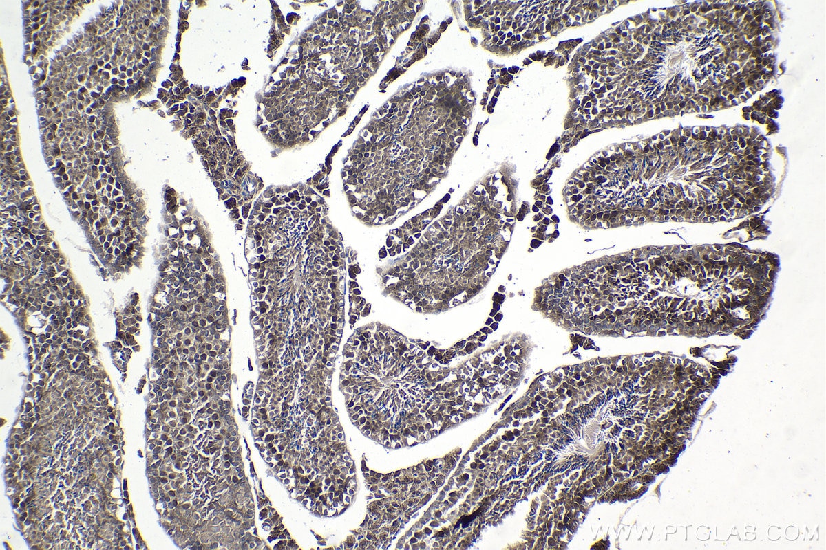 Immunohistochemical analysis of paraffin-embedded mouse testis tissue slide using KHC1012 (YPEL5 IHC Kit).