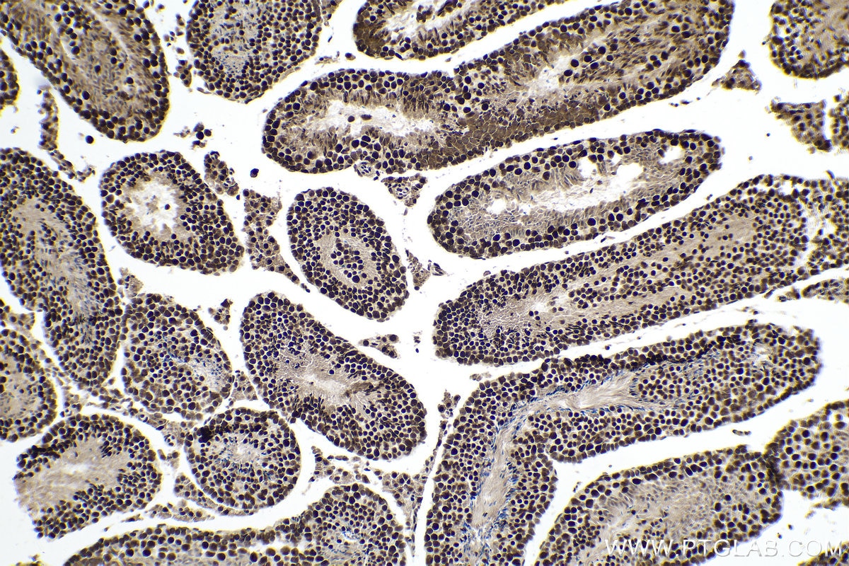 Immunohistochemical analysis of paraffin-embedded mouse testis tissue slide using KHC0155 (YTHDC1 IHC Kit).