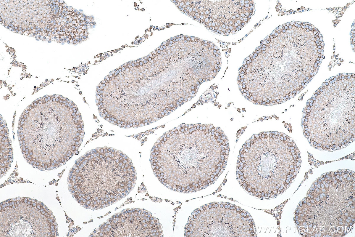 Immunohistochemical analysis of paraffin-embedded rat testis tissue slide using KHC0156 (YTHDC2 IHC Kit).