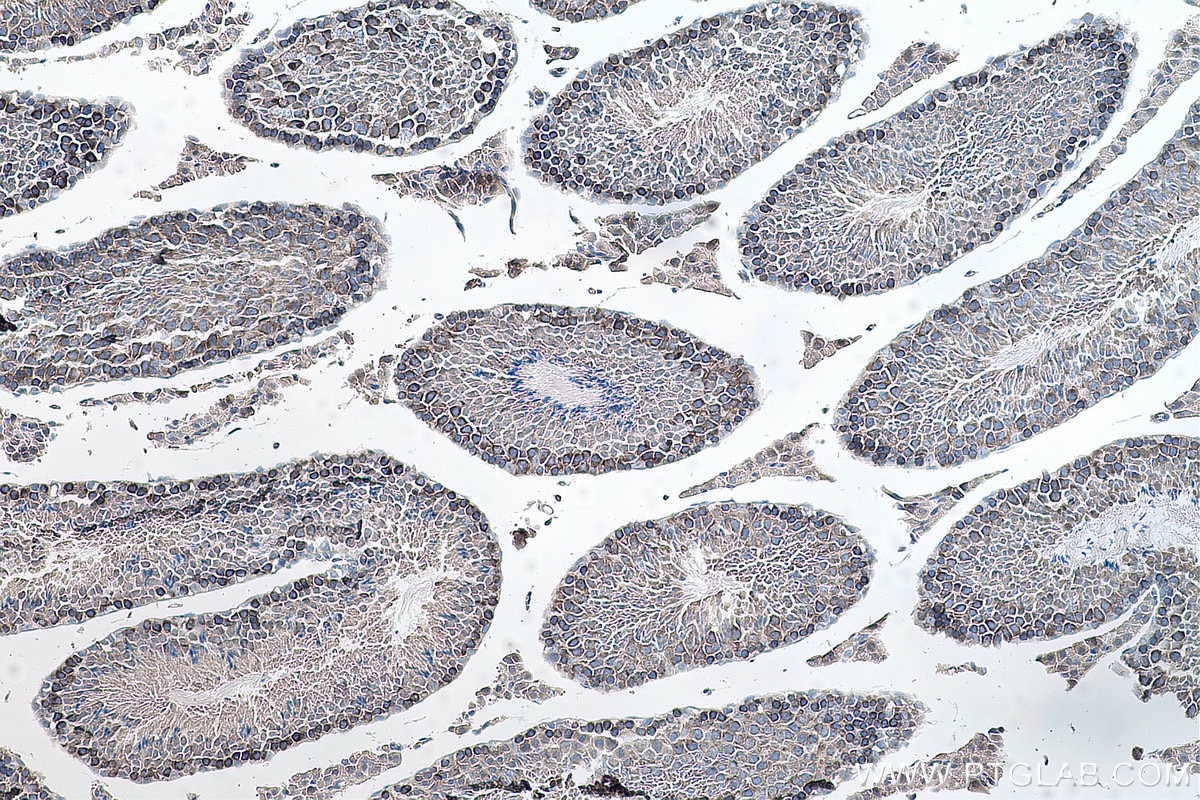 Immunohistochemical analysis of paraffin-embedded mouse testis tissue slide using KHC0156 (YTHDC2 IHC Kit).