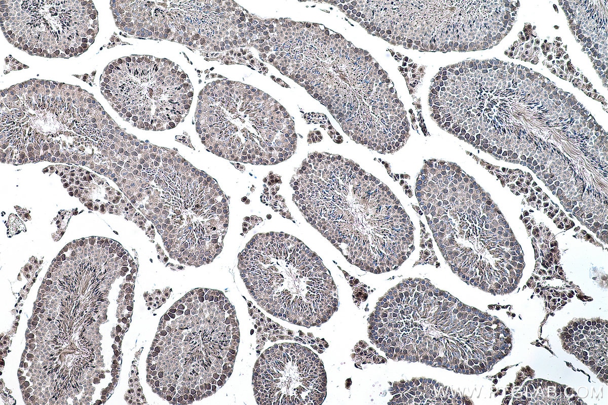 Immunohistochemical analysis of paraffin-embedded mouse testis tissue slide using KHC0158 (YTHDF2 IHC Kit).