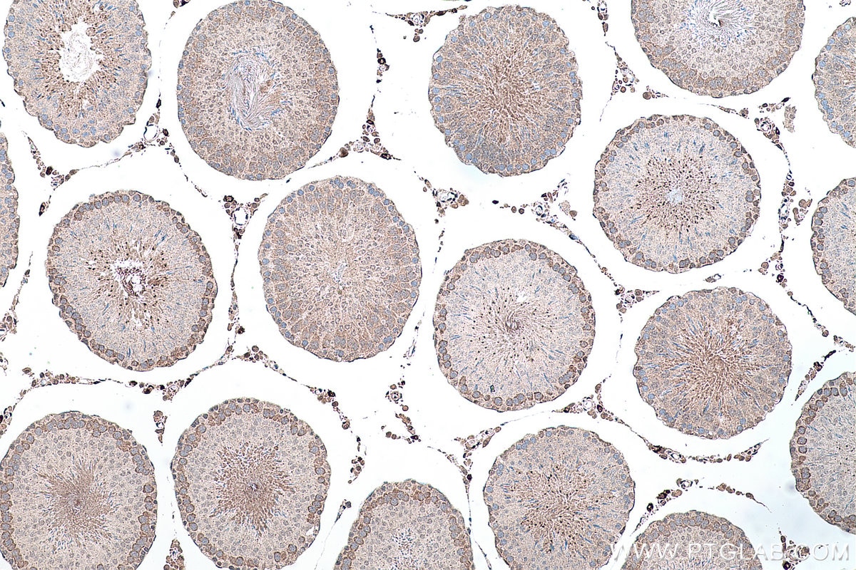 Immunohistochemical analysis of paraffin-embedded rat testis tissue slide using KHC0158 (YTHDF2 IHC Kit).