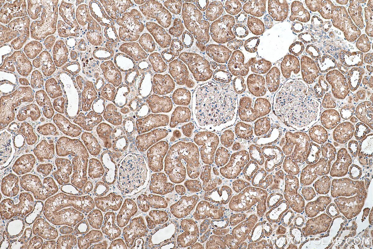 Immunohistochemical analysis of paraffin-embedded human kidney tissue slide using KHC0701 (YWHAB IHC Kit).