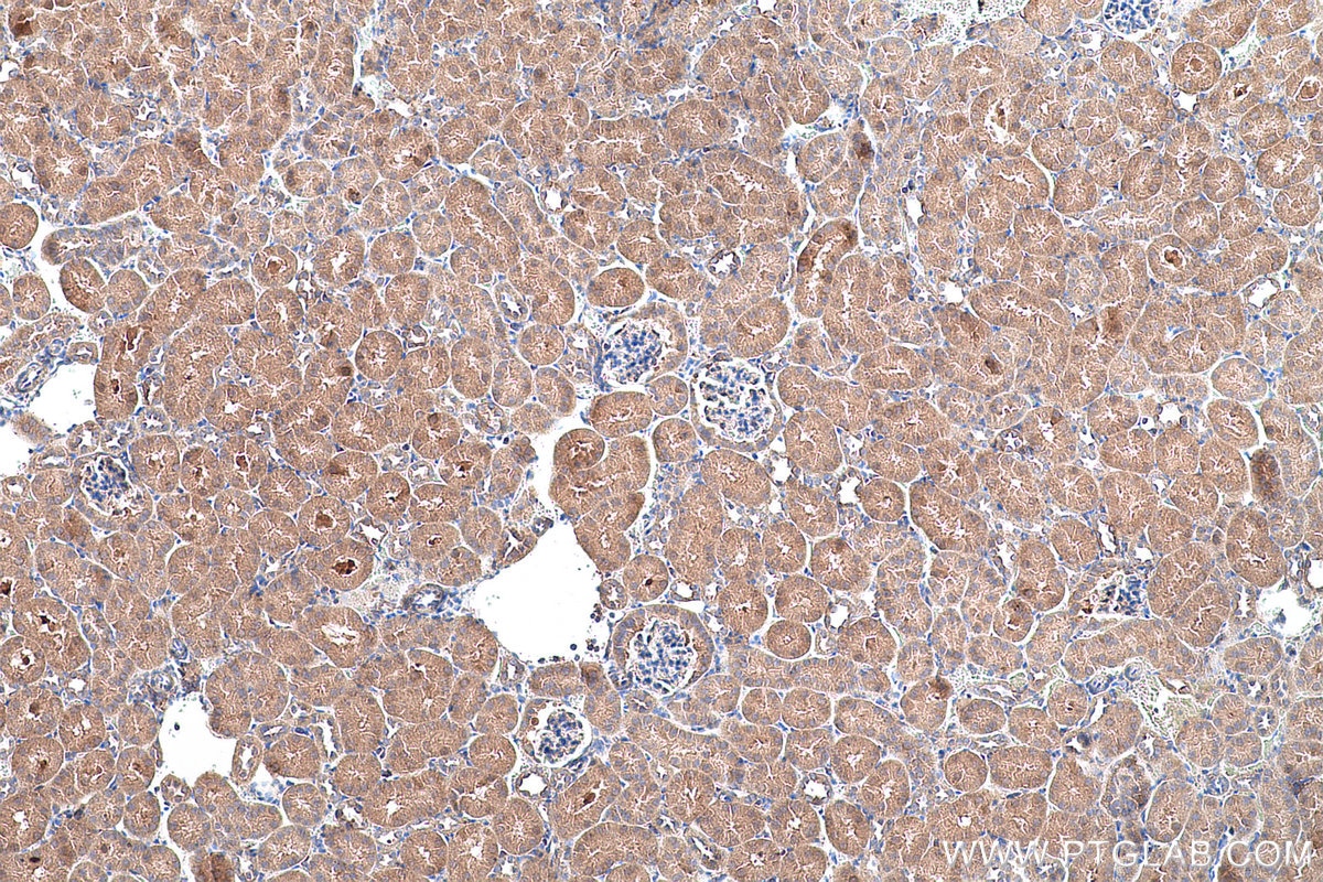 Immunohistochemical analysis of paraffin-embedded mouse kidney tissue slide using KHC0701 (YWHAB IHC Kit).