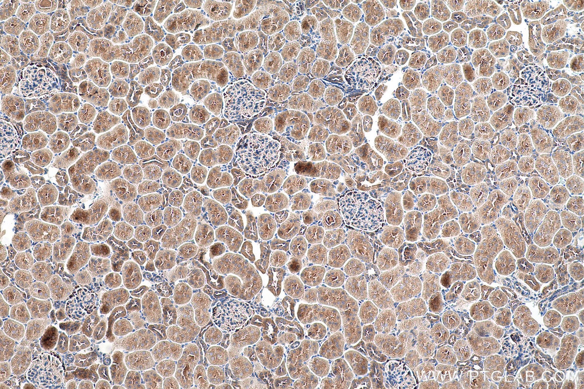 Immunohistochemical analysis of paraffin-embedded rat kidney tissue slide using KHC0701 (YWHAB IHC Kit).