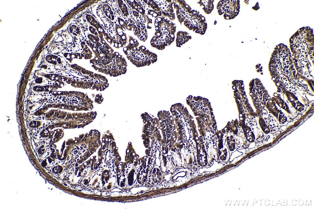 Immunohistochemical analysis of paraffin-embedded mouse small intestine tissue slide using KHC1805 (ZBTB33 IHC Kit).