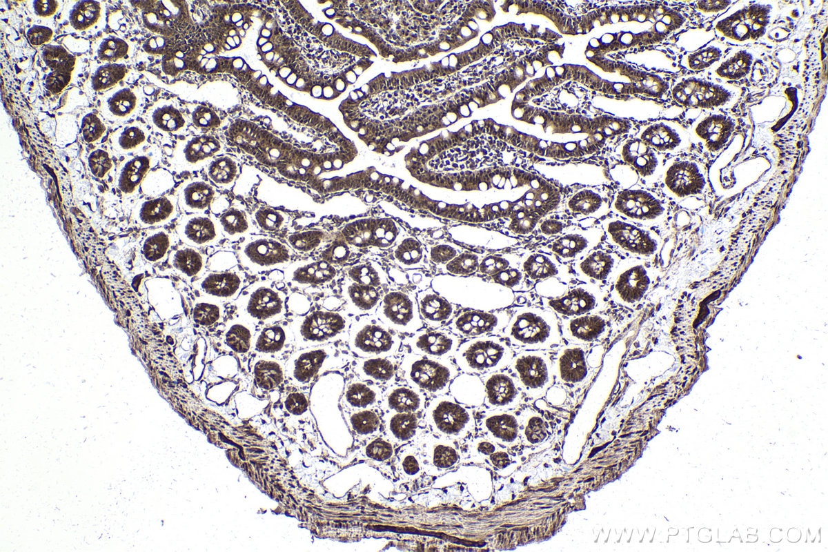 Immunohistochemical analysis of paraffin-embedded rat small intestine tissue slide using KHC1805 (ZBTB33 IHC Kit).