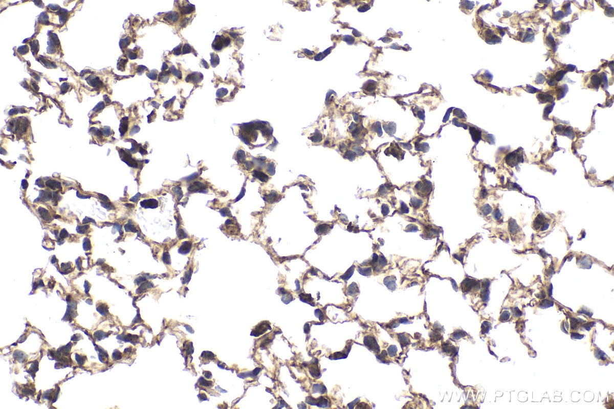 Immunohistochemical analysis of paraffin-embedded mouse lung tissue slide using KHC1794 (ZBTB49 IHC Kit).