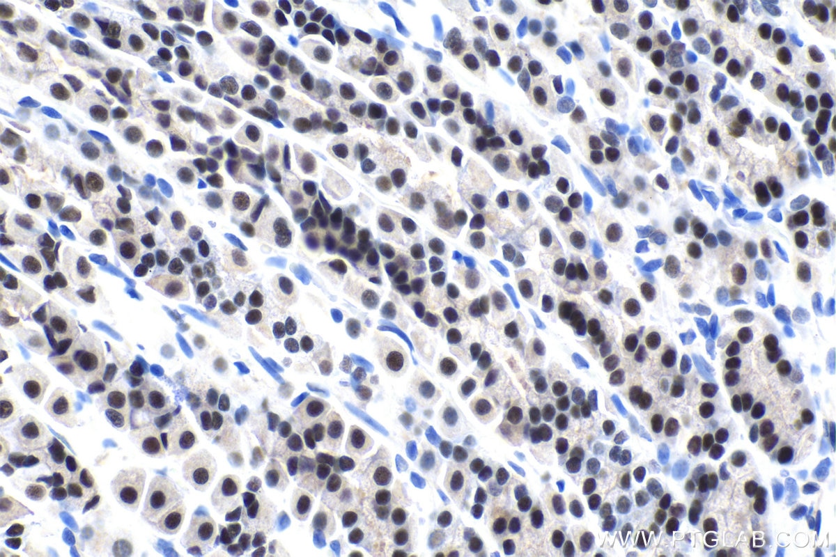 Immunohistochemical analysis of paraffin-embedded rat stomach tissue slide using KHC1435 (ZBTB7B IHC Kit).
