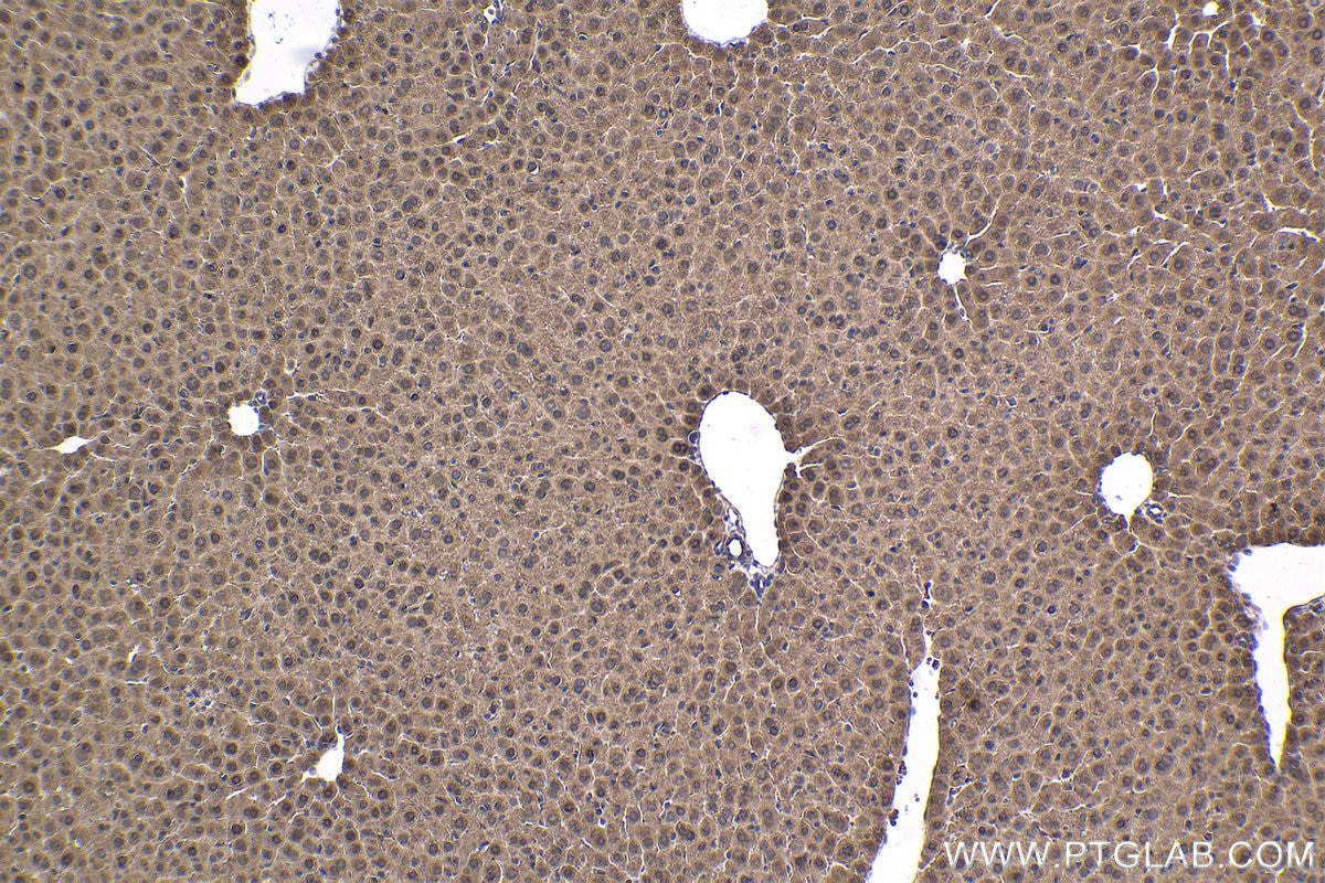 Immunohistochemical analysis of paraffin-embedded mouse liver tissue slide using KHC1774 (ZC3H12A IHC Kit).