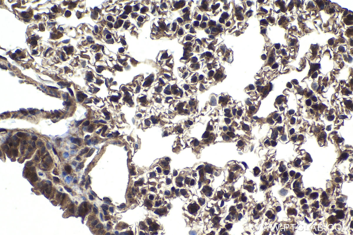 Immunohistochemical analysis of paraffin-embedded mouse lung tissue slide using KHC1774 (ZC3H12A IHC Kit).