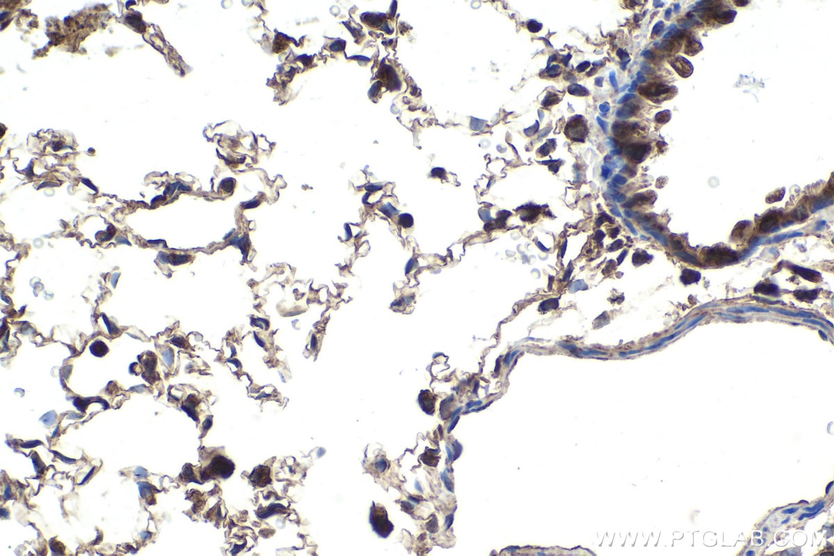 Immunohistochemical analysis of paraffin-embedded rat lung tissue slide using KHC1774 (ZC3H12A IHC Kit).