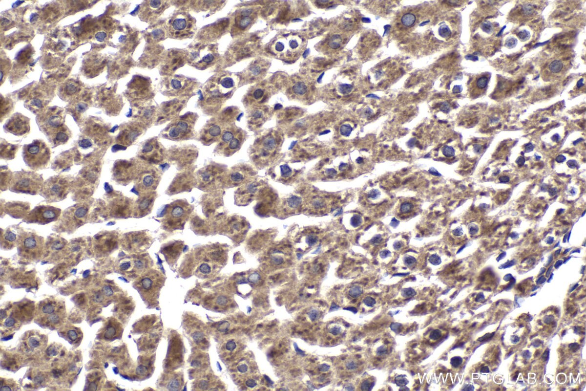 Immunohistochemical analysis of paraffin-embedded rat liver tissue slide using KHC2038 (ZC3H12D IHC Kit).