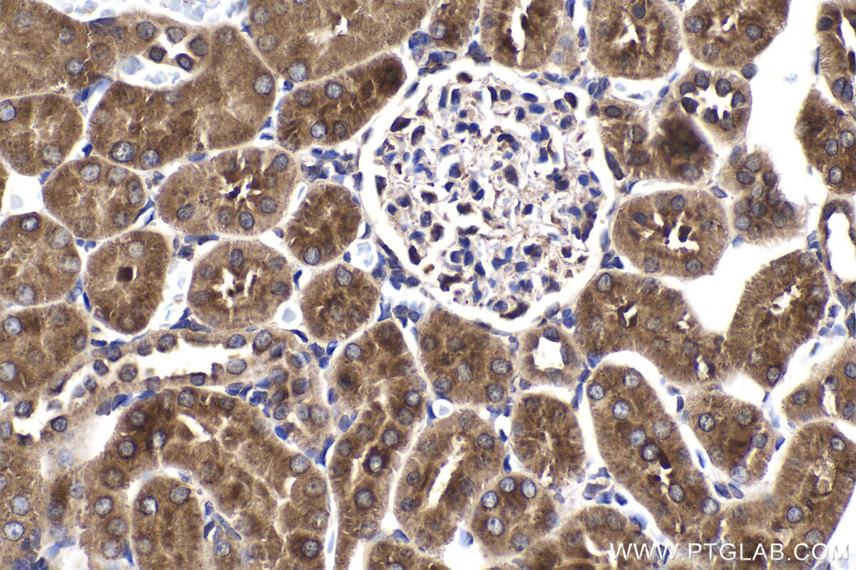 Immunohistochemical analysis of paraffin-embedded rat kidney tissue slide using KHC2038 (ZC3H12D IHC Kit).