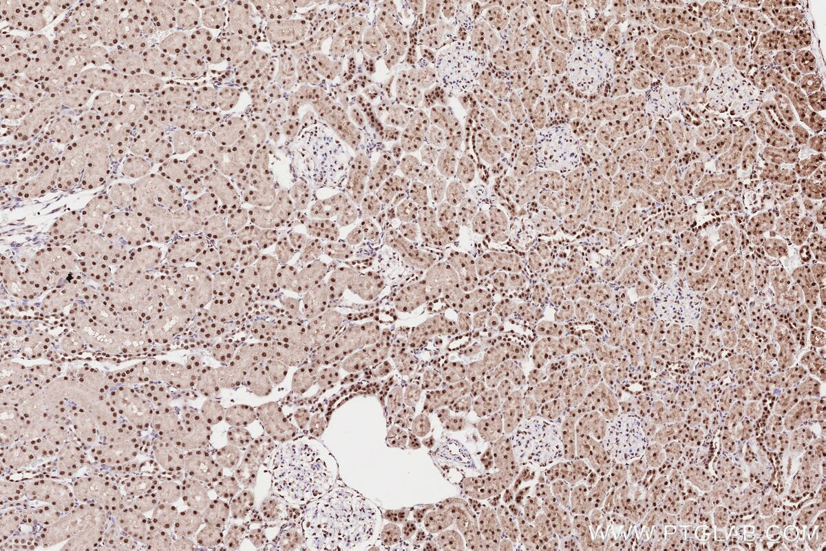 Immunohistochemical analysis of paraffin-embedded rat kidney tissue slide using KHC2593 (ZC3H14 IHC Kit).