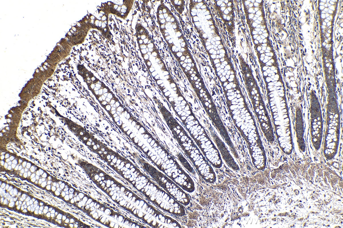 Immunohistochemical analysis of paraffin-embedded human colon tissue slide using KHC1232 (ZC3H15 IHC Kit).