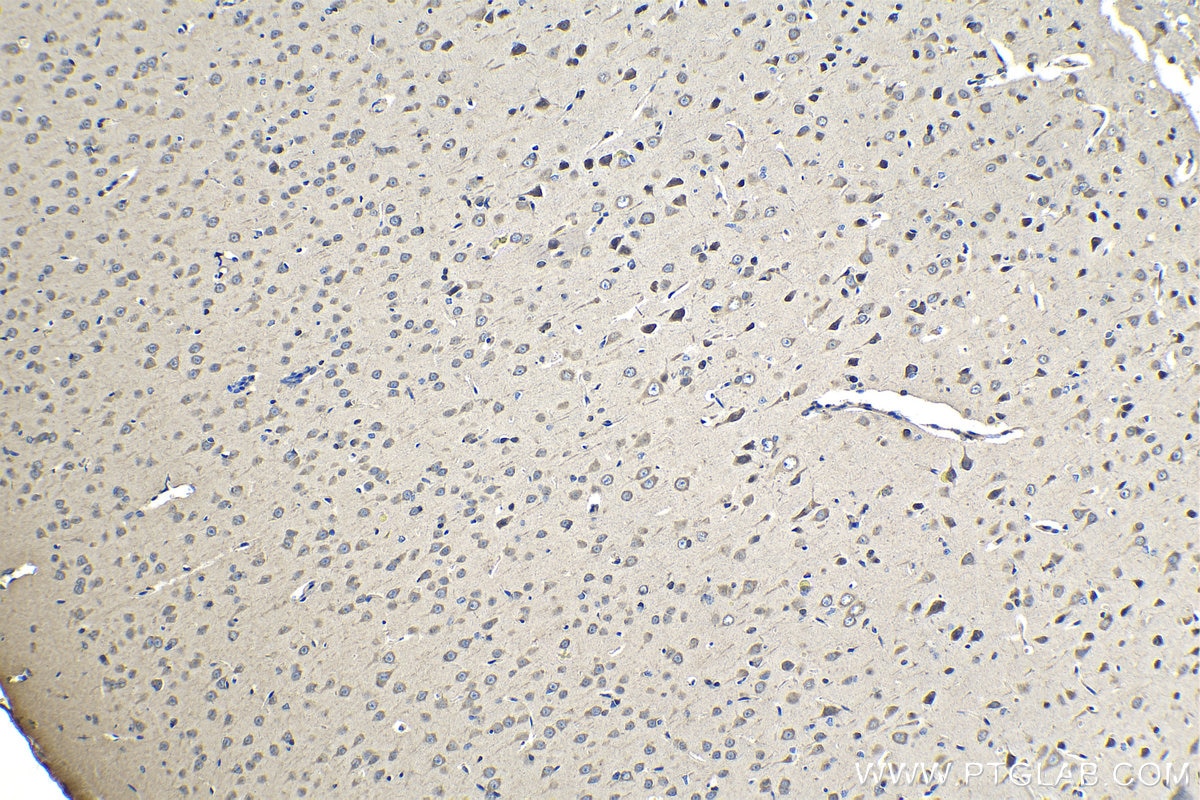 Immunohistochemical analysis of paraffin-embedded rat brain tissue slide using KHC1232 (ZC3H15 IHC Kit).