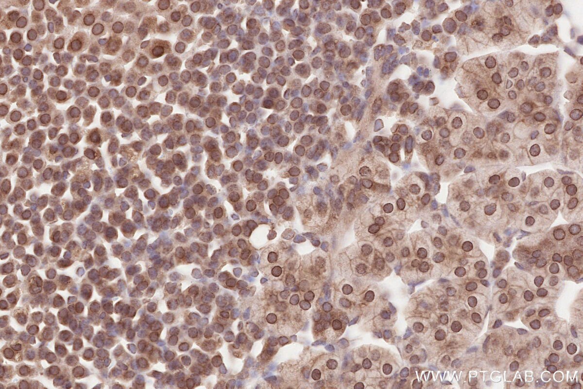 Immunohistochemical analysis of paraffin-embedded mouse adrenal gland tissue slide using KHC2637 (ZC3HC1 IHC Kit).