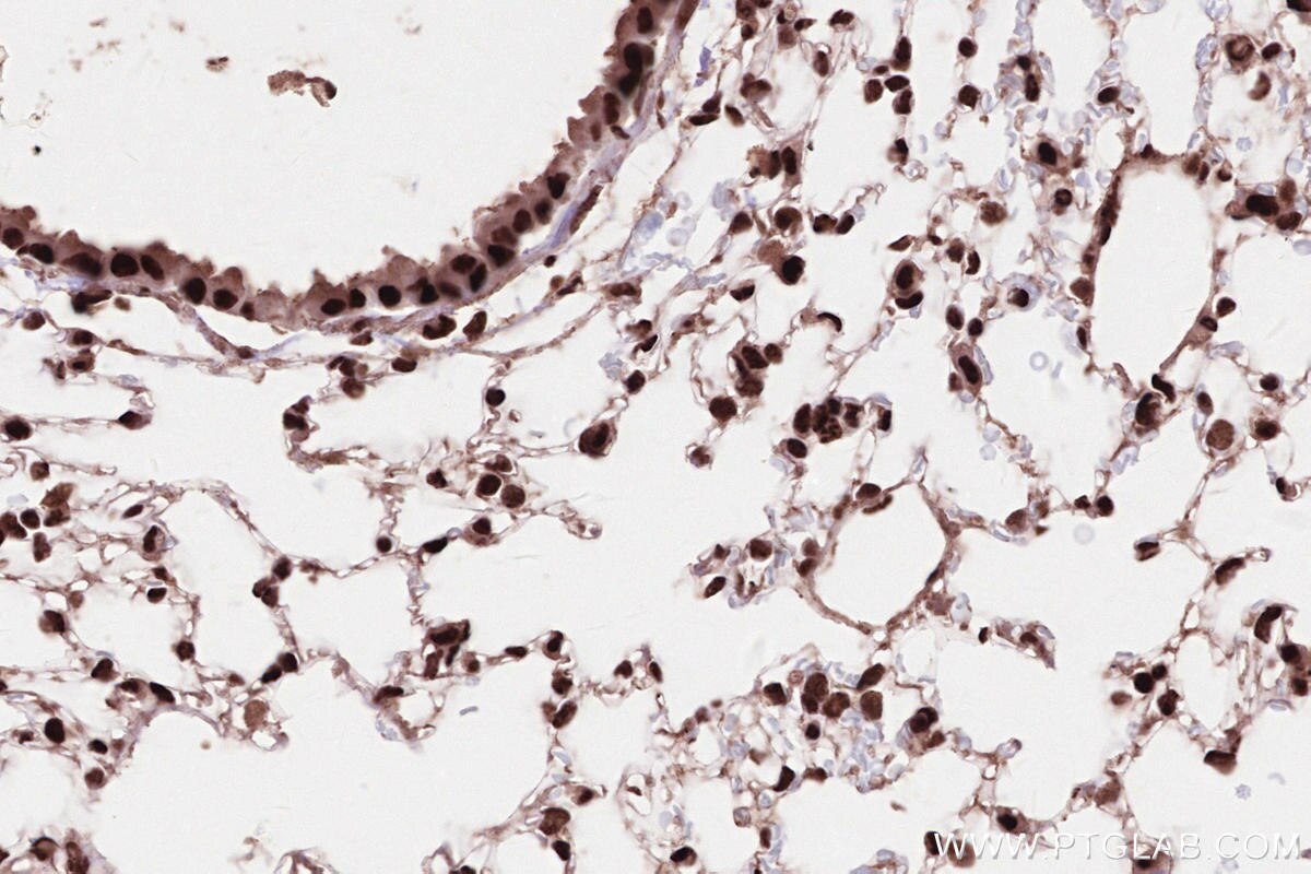 Immunohistochemical analysis of paraffin-embedded mouse lung tissue slide using KHC2584 (ZCCHC8 IHC Kit).