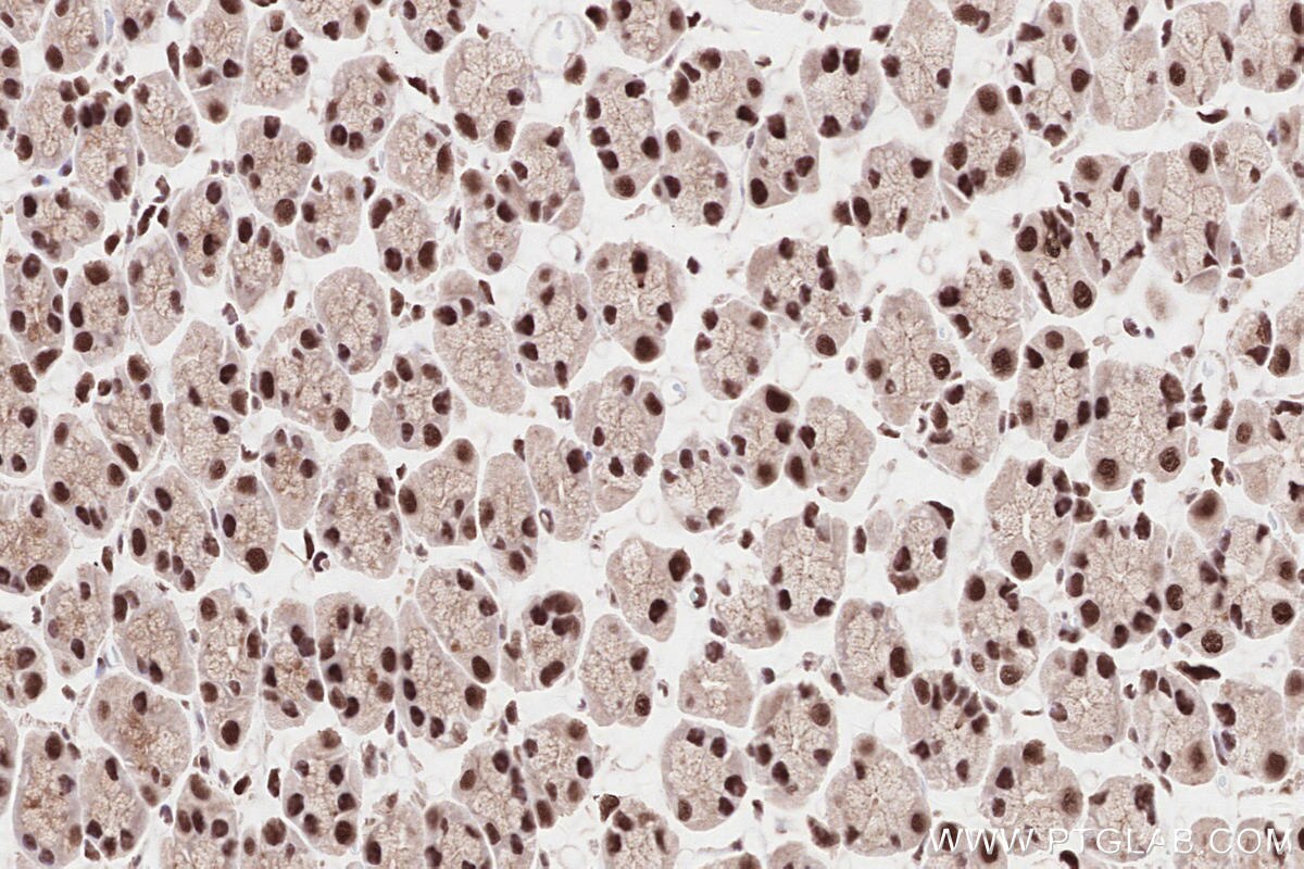 Immunohistochemical analysis of paraffin-embedded rat stomach tissue slide using KHC2584 (ZCCHC8 IHC Kit).