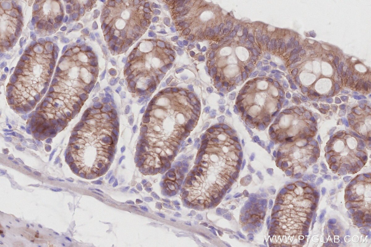 Immunohistochemical analysis of paraffin-embedded mouse colon tissue slide using KHC2891 (ZDHHC5 IHC Kit).