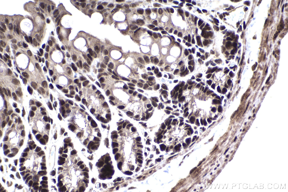 Immunohistochemical analysis of paraffin-embedded mouse colon tissue slide using KHC1457 (ZFP161 IHC Kit).