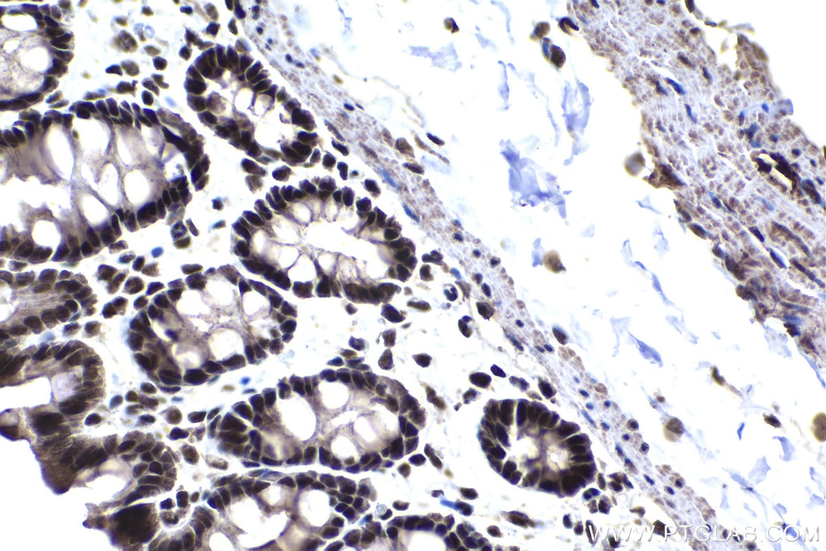 Immunohistochemical analysis of paraffin-embedded rat colon tissue slide using KHC1457 (ZFP161 IHC Kit).