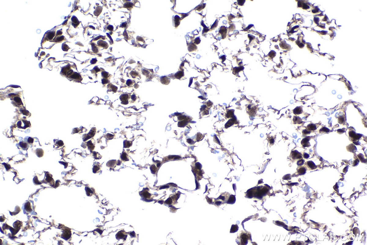 Immunohistochemical analysis of paraffin-embedded rat lung tissue slide using KHC1457 (ZFP161 IHC Kit).