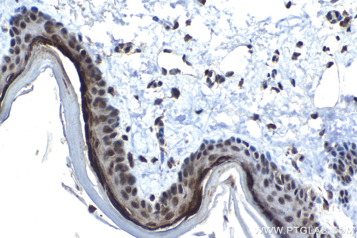 Immunohistochemical analysis of paraffin-embedded rat skin tissue slide using KHC1567 (ZFP36 IHC Kit).