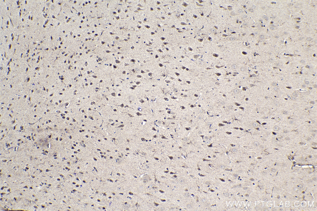 Immunohistochemical analysis of paraffin-embedded rat brain tissue slide using KHC1567 (ZFP36 IHC Kit).