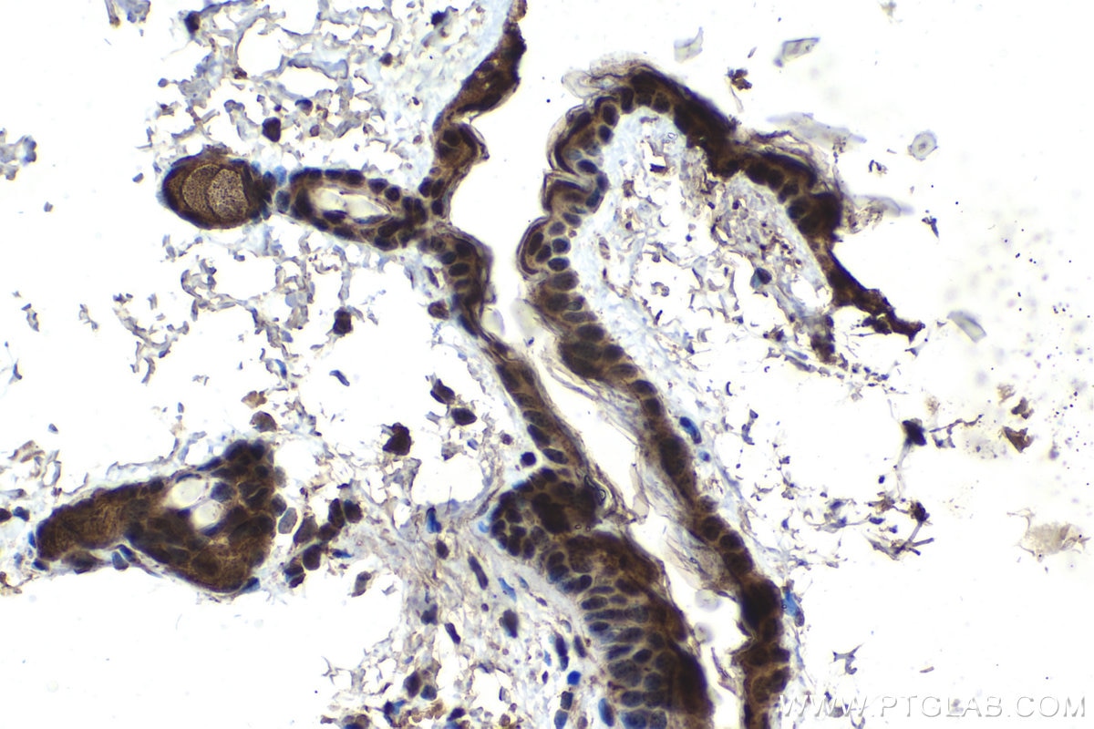 Immunohistochemical analysis of paraffin-embedded mouse skin tissue slide using KHC1567 (ZFP36 IHC Kit).