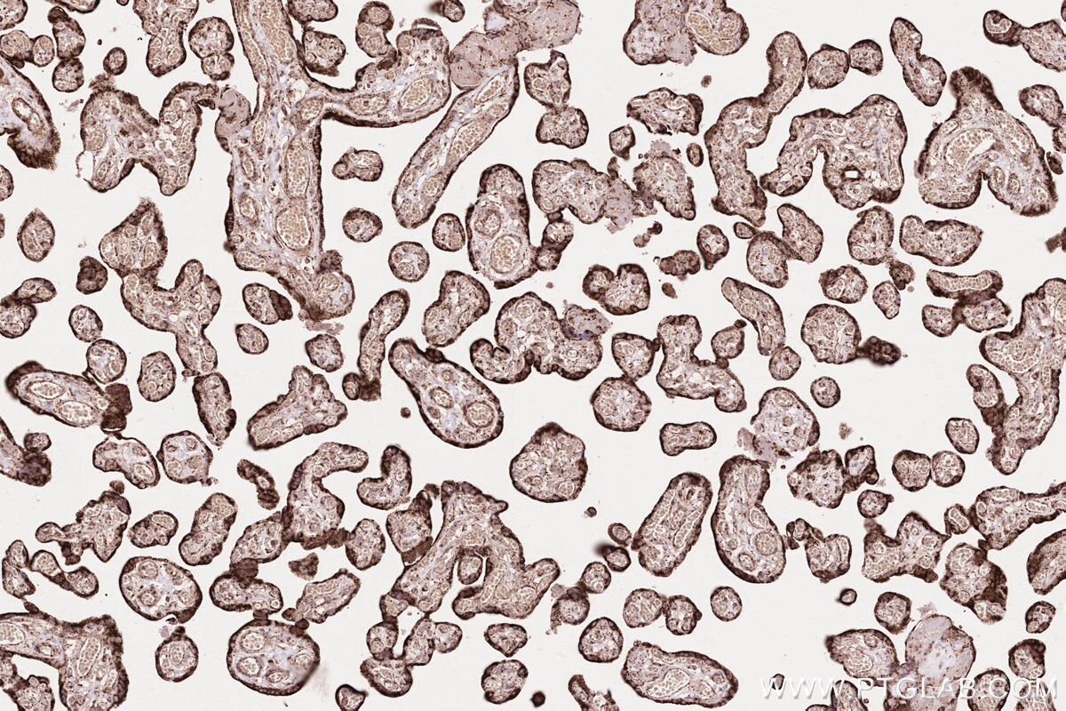 Immunohistochemical analysis of paraffin-embedded human placenta tissue slide using KHC2572 (ZFYVE26 IHC Kit).