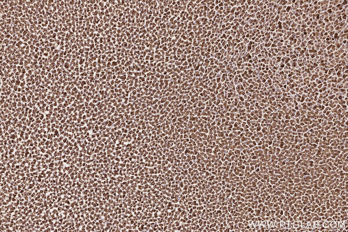 Immunohistochemical analysis of paraffin-embedded rat adrenal gland tissue slide using KHC2572 (ZFYVE26 IHC Kit).
