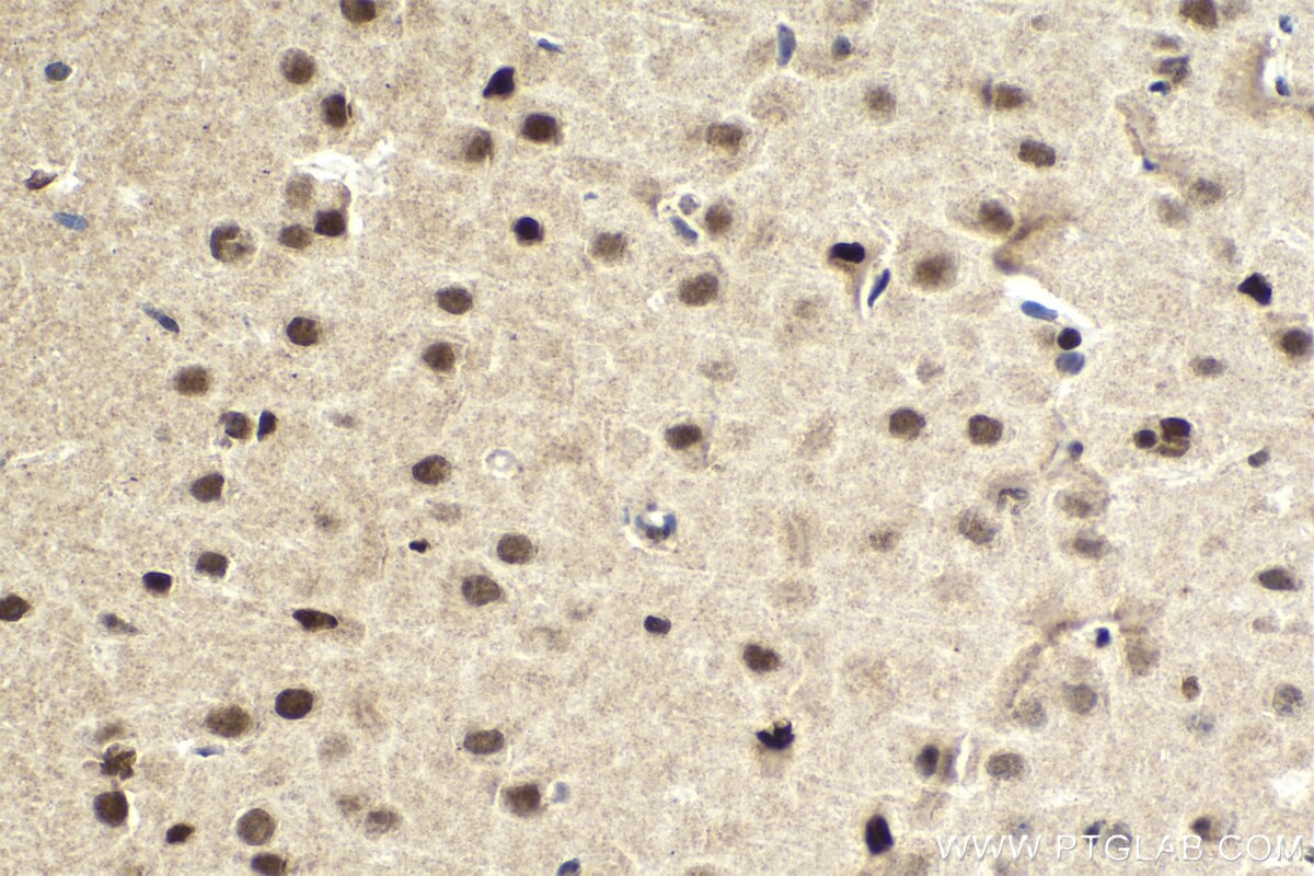 Immunohistochemical analysis of paraffin-embedded mouse brain tissue slide using KHC2034 (ZHX2 IHC Kit).