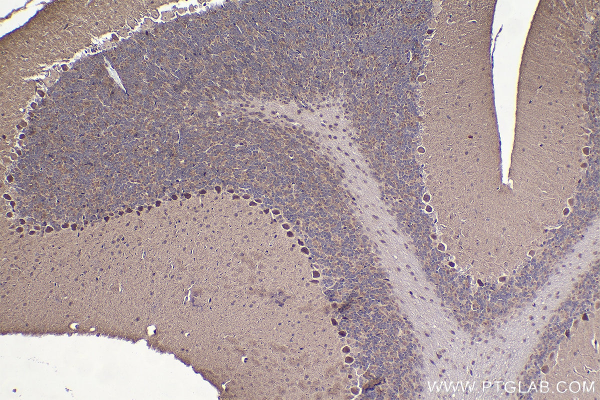 Immunohistochemical analysis of paraffin-embedded mouse cerebellum tissue slide using KHC1467 (ZIC3 IHC Kit).