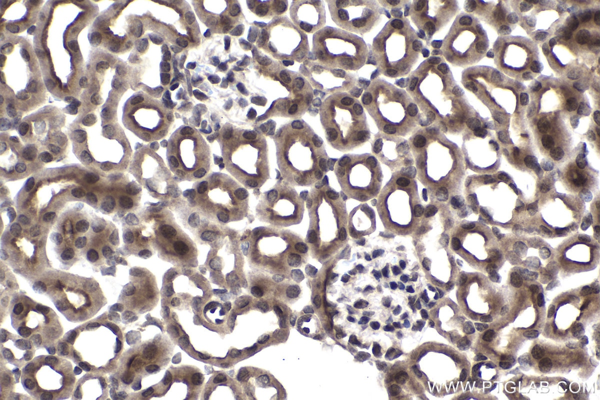 Immunohistochemical analysis of paraffin-embedded mouse kidney tissue slide using KHC1478 (ZMPSTE24 IHC Kit).
