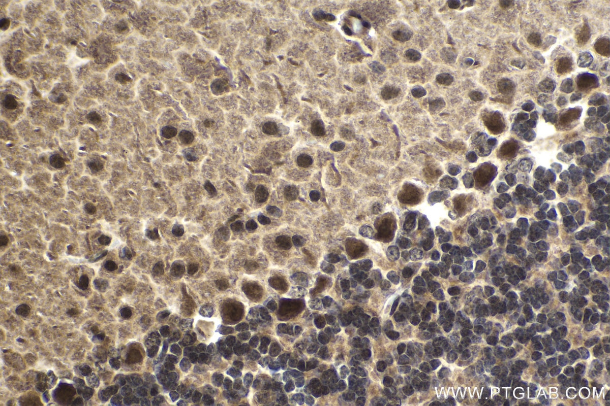 Immunohistochemical analysis of paraffin-embedded mouse cerebellum tissue slide using KHC1478 (ZMPSTE24 IHC Kit).