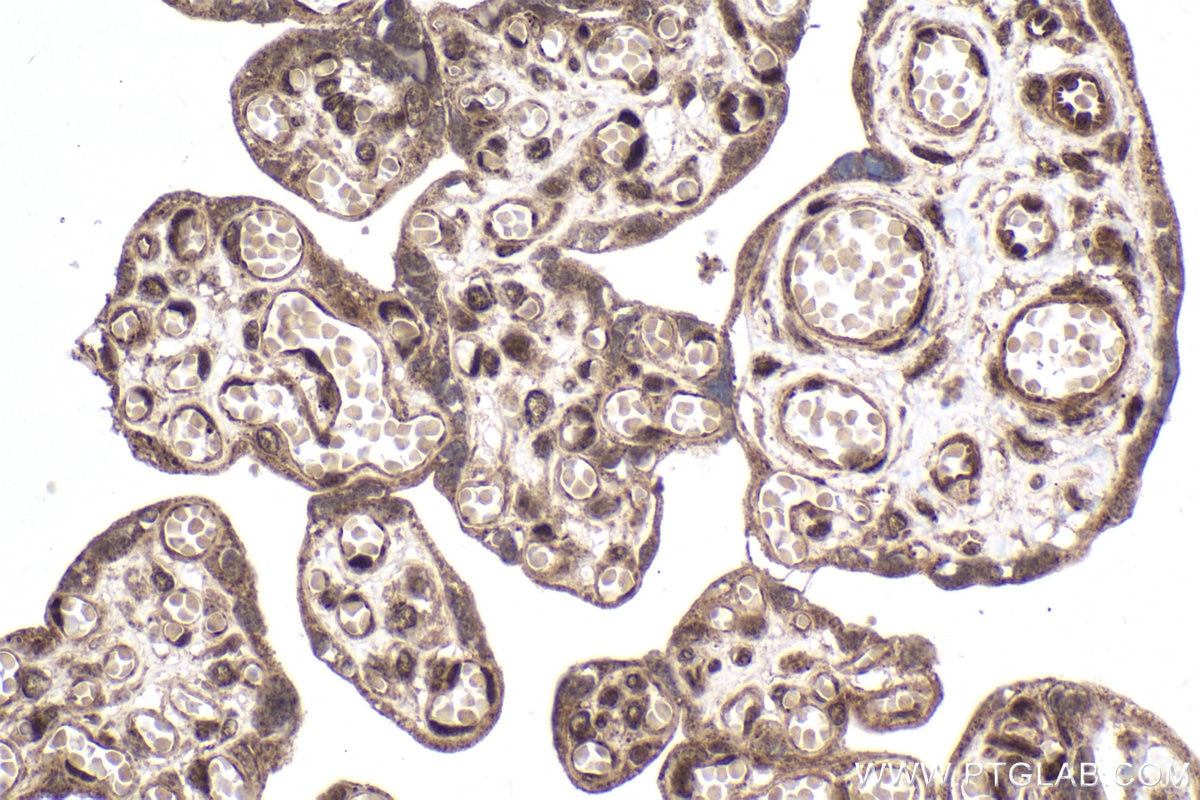 Immunohistochemical analysis of paraffin-embedded human placenta tissue slide using KHC1998 (ZMYND8 IHC Kit).